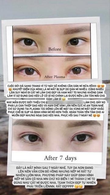 Vợ TGĐ Phan Thành đang bỉm sữa vẫn đi nhấn mí-3