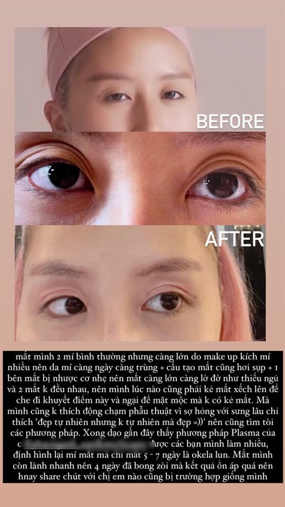 Vợ TGĐ Phan Thành đang bỉm sữa vẫn đi nhấn mí-8