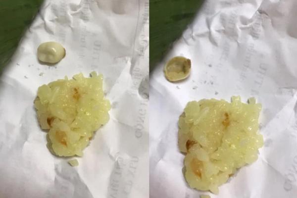 Eating sticky rice suddenly chewed on a creepy foreign object, the girl was so confused