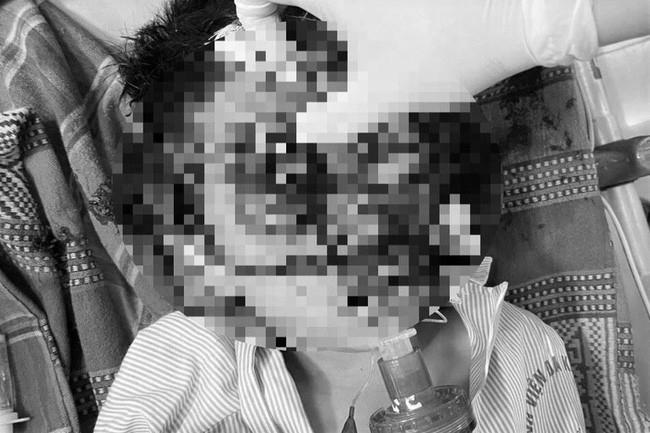 Nghịch súng, bé trai bị 11 viên đạn bi găm vào đầu tử vong-1