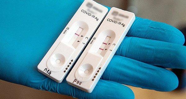 What is the difference between F0 infected with Omicron and F0 infected with Delta?-1