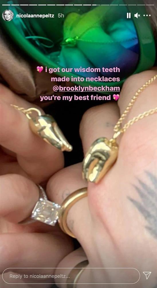 Why do Brooklyn Beckham and his wife wear each other's gold-covered wisdom teeth?-2