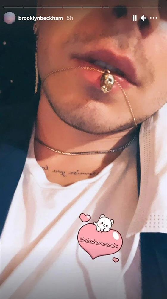 Tại sao Brooklyn Beckham và vợ đeo răng khôn bọc vàng của nhau?-3