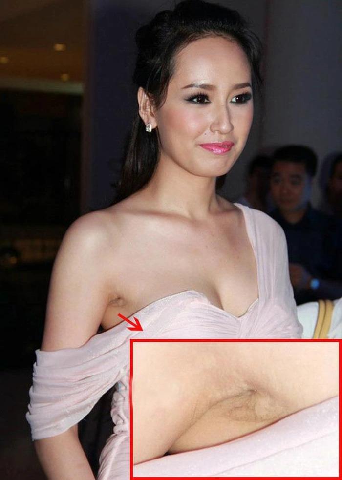 Mỹ nhân Việt và những lần để lộ vùng nách thâm đen, mỡ thừa-8