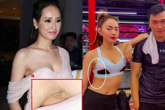 Mỹ nhân Việt và những lần để lộ vùng nách thâm đen, mỡ thừa