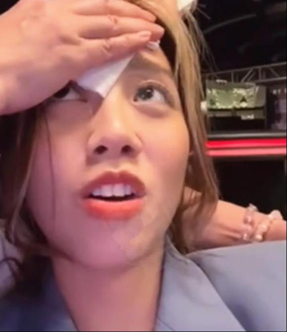 Sao nữ TVB chấn thương khâu 16 mũi do tài tử nổi tiếng chơi xấu?-2