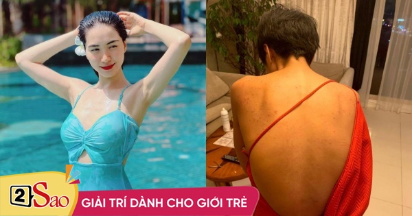 Hoa Minzy asked for help because of her back acne after Covid-19, she didn’t dare to wear a bikini