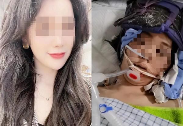 Wife talking to a man of the opposite sex was violently abused by her husband to death-1