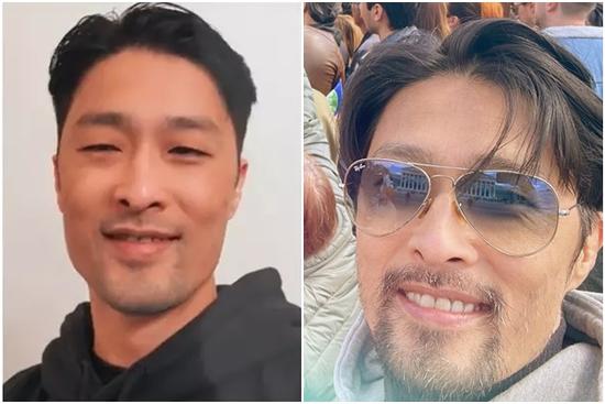 Johnny Trí Nguyễn lại xấu đi sau hơn 1 tháng tút tát ngoại hình