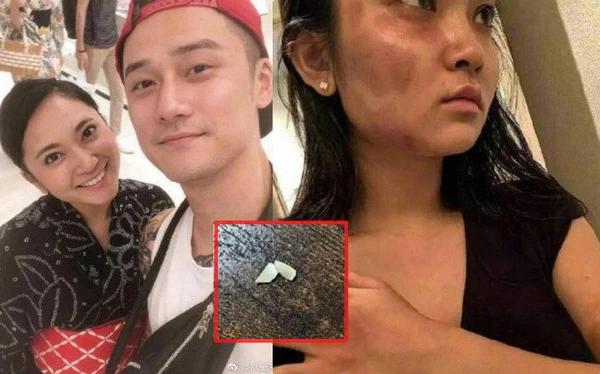 Actor Bo Bo Kinh Tinh became a shipper after the scandal of abuse of his girlfriend-5