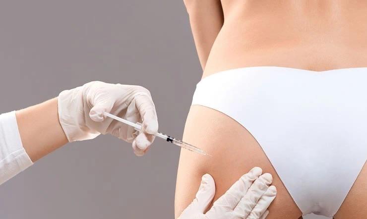 Nâng vòng 3 kiểu Brazil và các xu hướng thẩm mỹ được ưa chuộng-1