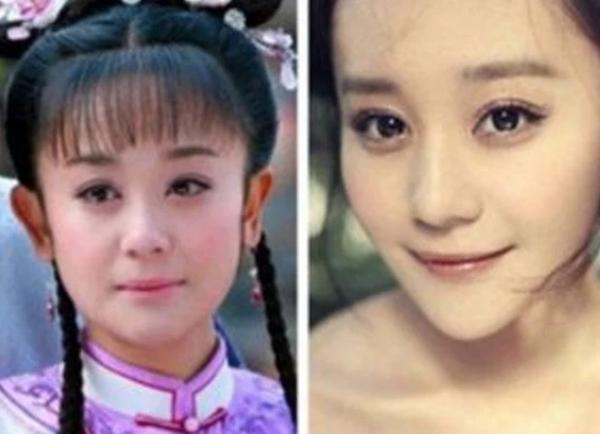 Hạ Tử Vy xấu nhất màn ảnh: Lạm dụng dao kéo đến lao dốc sự nghiệp-8