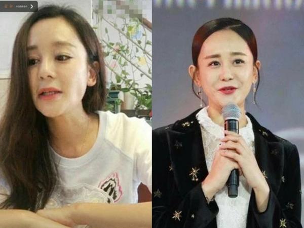 Hạ Tử Vy xấu nhất màn ảnh: Lạm dụng dao kéo đến lao dốc sự nghiệp-9