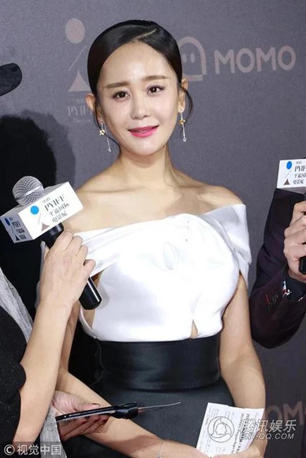 Hạ Tử Vy xấu nhất màn ảnh: Lạm dụng dao kéo đến lao dốc sự nghiệp-11