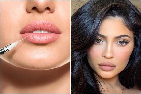 Cô gái có đôi môi lớn nhất thế giới muốn bán đấu giá những nụ hôn-5