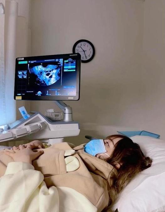 Múi Xù gặp hạn trước thời điểm chuyển phôi thai-1