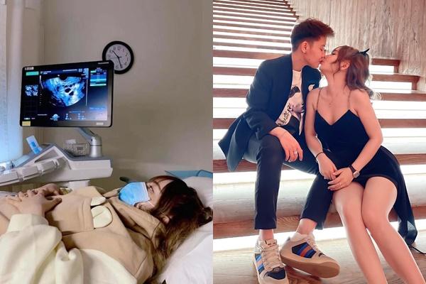 Chốt thời gian Múi Xù chuyển phôi sau 5 lần 7 lượt trì hoãn-3