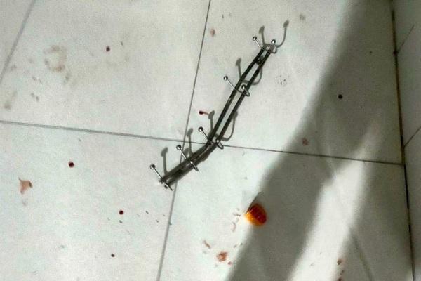 Chồng đánh vợ trước mặt 3 con: Chủ tịch thị xã chỉ đạo xác minh-2