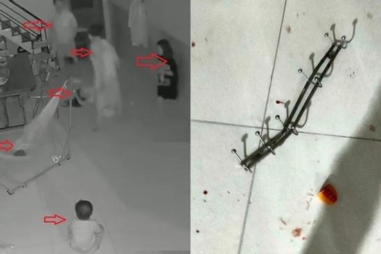 Chồng đánh vợ trước mặt 3 con: Chủ tịch thị xã chỉ đạo xác minh