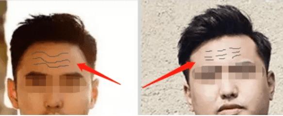 Vận số của một người có thể được nhìn thấy từ đường trán-2