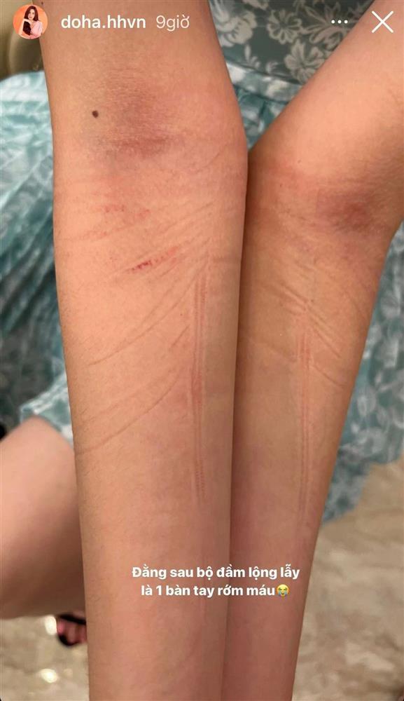 Đỗ Thị Hà đổ máu vì lên đồ lồng lộn ở Miss World Vietnam-3