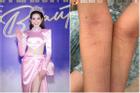 Đỗ Thị Hà 'đổ máu' vì lên đồ lồng lộn ở Miss World Vietnam