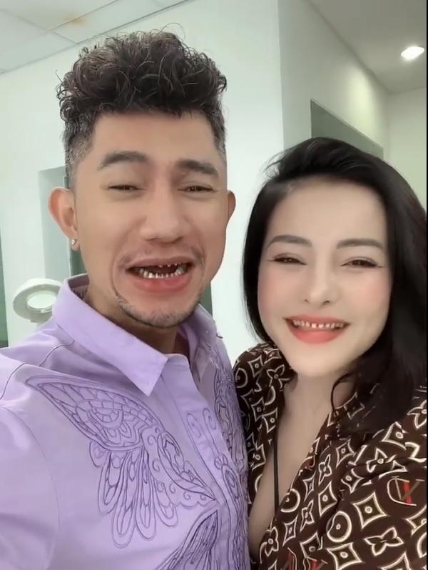 Ngân 98 và Lương Bằng Quang khoe hàm răng mài cụt gần đến lợi-2