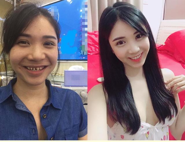 Ngân 98 và Lương Bằng Quang khoe hàm răng mài cụt gần đến lợi-6