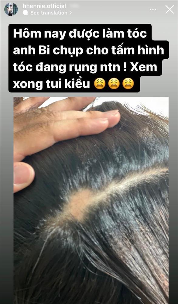 HHen Niê xổ mỡ, đầu hói cả mảng khi diện lại đồ Miss Universe 2018-8