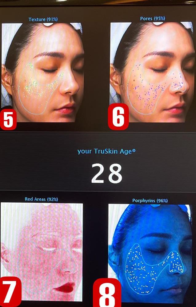 Hết lộ cằm gãy, Đoàn Di Băng xuất hiện với làn da sần sùi-5