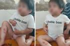 Hà Tĩnh: Bé gái nhập viện đầu rỉ máu, người bầm tím, nghi bị bạo hành