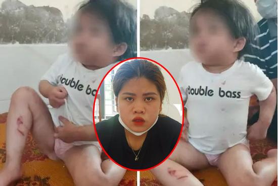 Dì ruột dùng cán chổi, móc áo đánh bé gái 3 ngày liền vì lười ăn