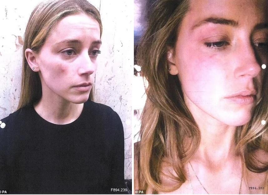 Cảnh sát khẳng định Johnny Depp không đánh Amber Heard-2