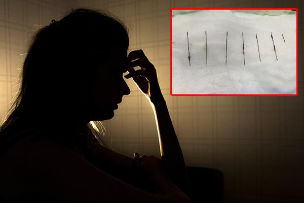 A woman stabbed herself with 7 sewing needles in her chest because of stress