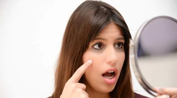 Trị quầng thâm mắt bằng dầu hạnh nhân và sữa lạnh-1