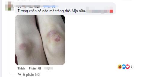 Sơn Tùng bầm dập cả người vì đóng MV nhảy lầu gây sốc-5