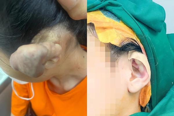 The girl’s huge tumor and the warning about piercing all over her body