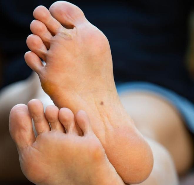 Nốt ruồi ở 6 vị trí này trên cơ thể tiết lộ gì về tính cách bạn?-4