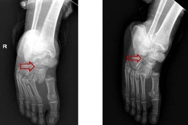 Thi thể người phụ nữ cháy đen và hành trình vạch mặt kẻ cuồng dâm-3