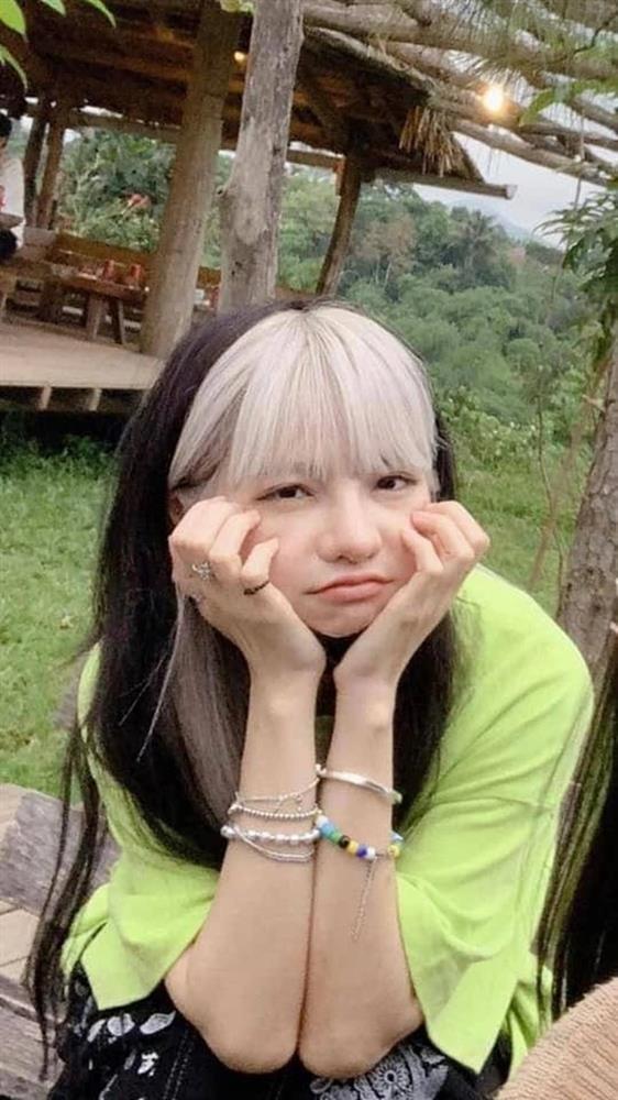 Gương mặt sưng húp của CiiN sau khi sửa mũi-3