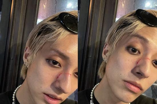 Nam ca sĩ Hàn bị đánh giữa đường vì là người đồng tính