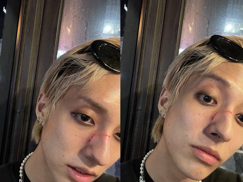 Nam ca sĩ Hàn bị đánh giữa đường vì là người đồng tính-1