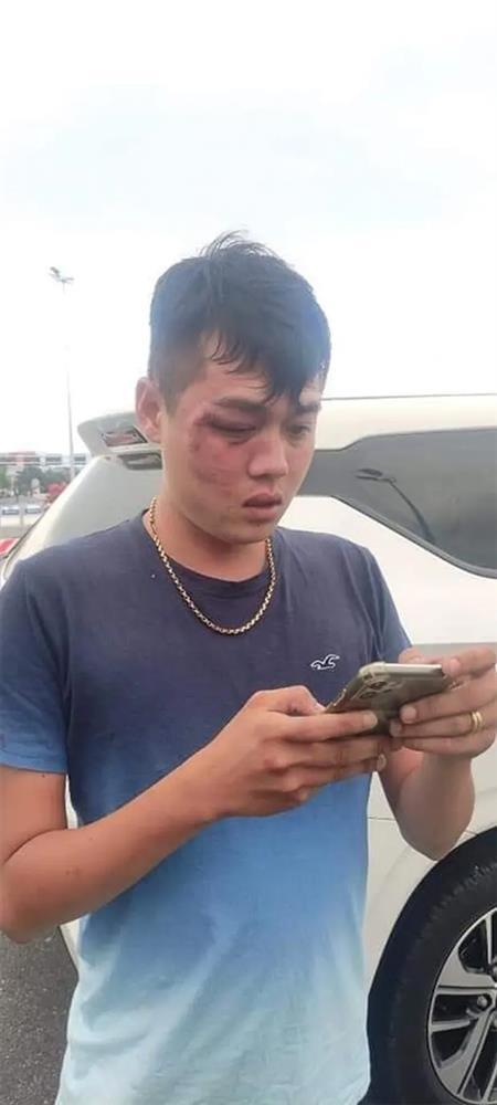 Clip: Tài xế grab bị nhóm thanh niên đấm đá túi bụi trên đường-2