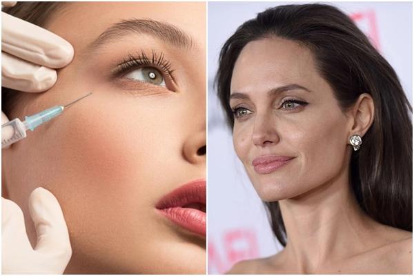 Tiêm filler đội lốt collagen, nhiều người gặp biến chứng-3