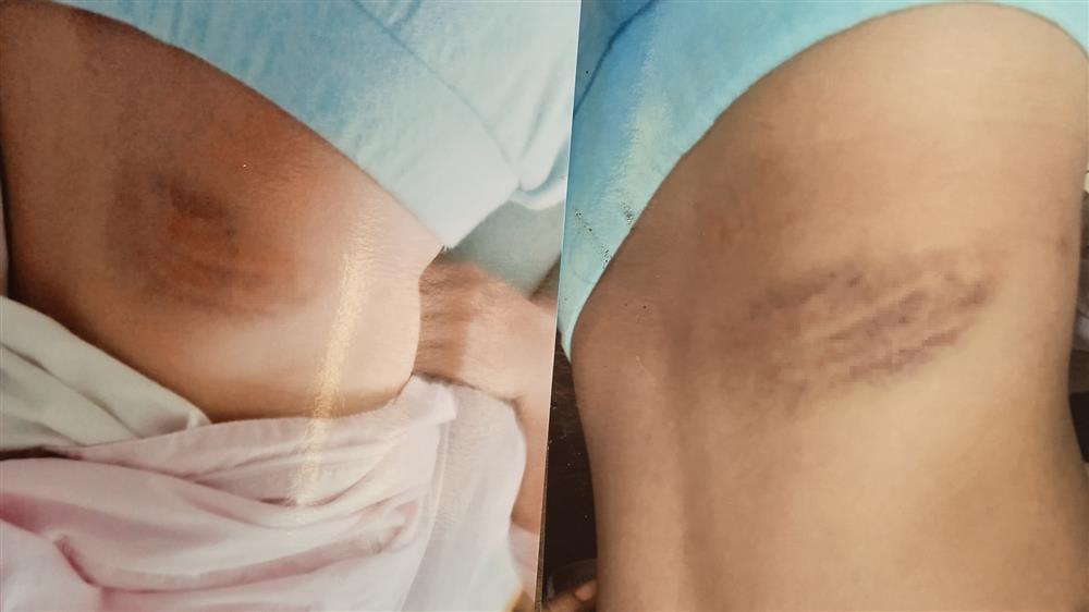 Hà Nội: 2 cháu bị cha dượng bạo hành, ông bà nội làm đơn cầu cứu-1