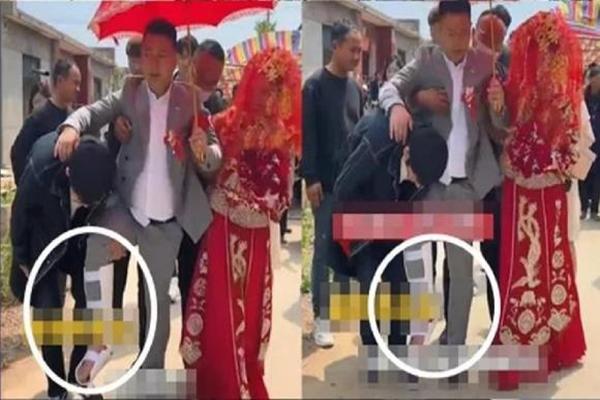 The groom broke his leg on his wedding day because of your malicious joke