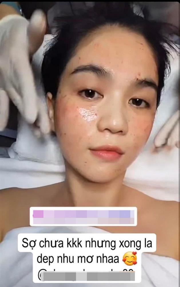 Ngọc Trinh nám đầy mặt, toang làn da nuột nà trứ danh-6