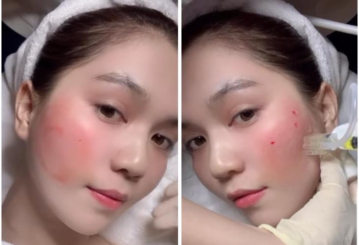 Ngọc Trinh nám đầy mặt, toang làn da nuột nà trứ danh-7