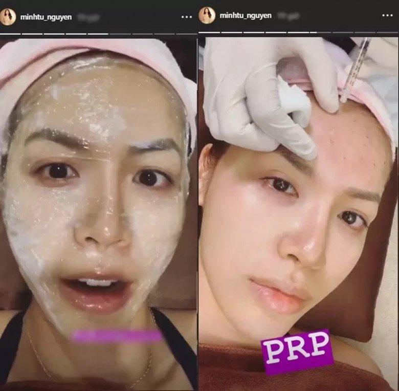 Ngọc Trinh mặt ủ dột, da be bét máu, chuyện gì đây?-7