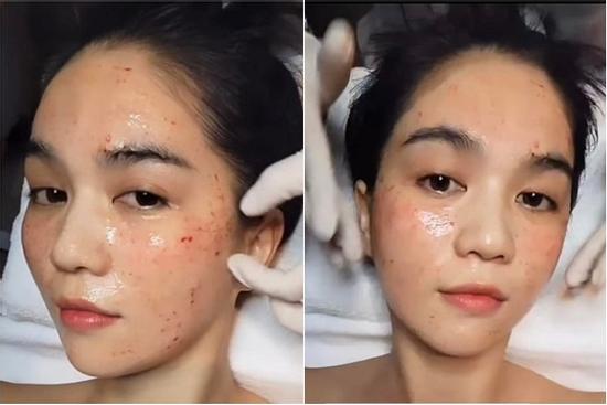 Ngọc Trinh mặt ủ dột, da be bét máu, chuyện gì đây?